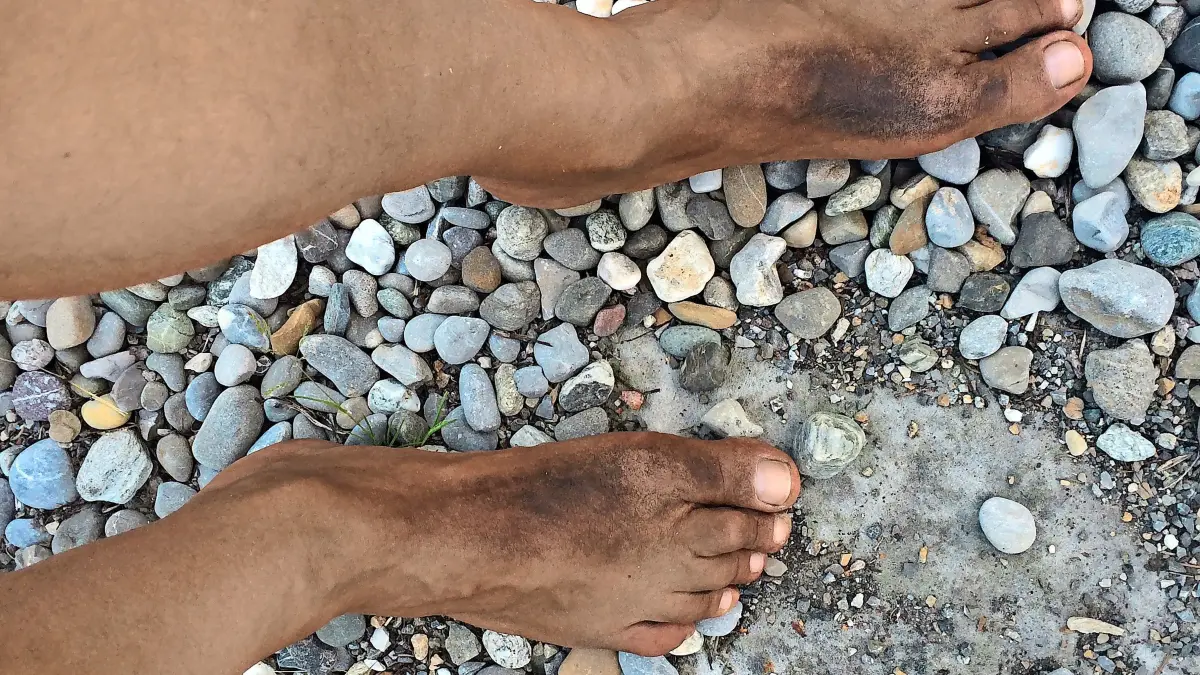 Aldo Berti ist überzeugt: Barfußlaufen ist gesund.