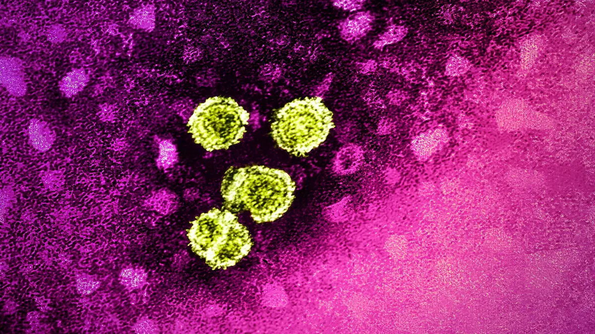 Hepatitis C Viren
