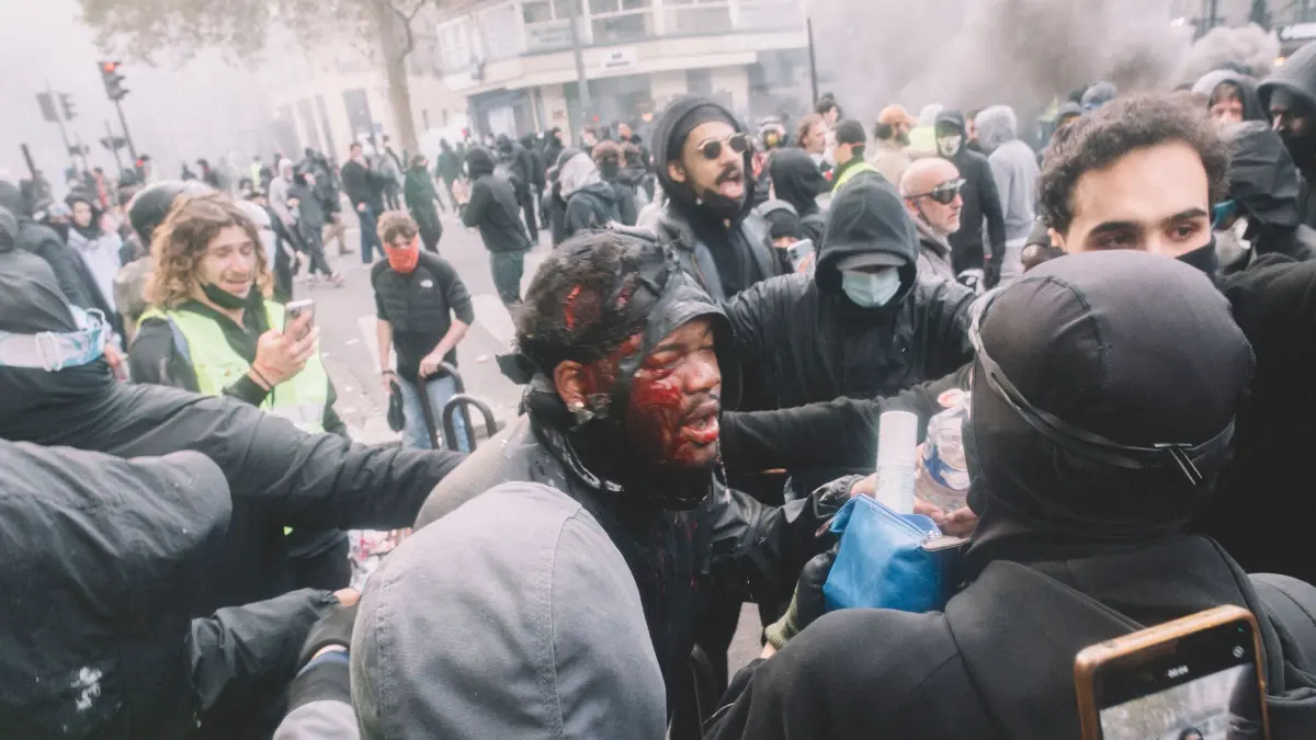 Protesttag in Frankreich: 17.10.2026, Frankreich, Paris: Ein verletzter Demonstrant mit blutendem Gesicht wird auf dem Place de la République in Paris von anderen Menschen versorgt. Foto: Fabian Suspensivo/ZUMA Press Wire/dpa +++ dpa-Bildfunk +++