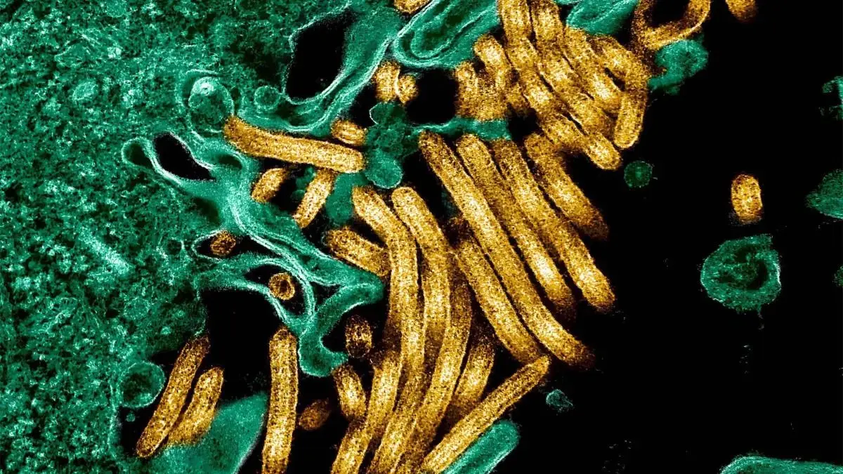 Kolorierte Aufnahme von Ebolaviren mit dem Elektronenmikroskop.